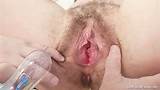 Milf Hairy Pussy Gyno Eamination In Hospital Free Mobile Porn Video ...